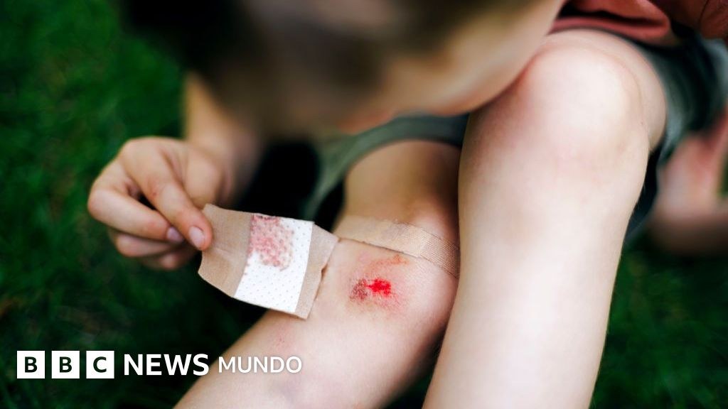 Mercurocromo, el antiséptico con el que curaron las heridas de millones de niños en todo el mundo y terminó prohibido